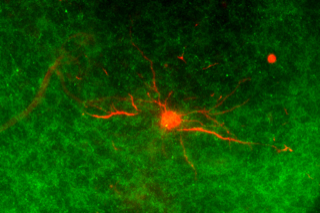 扁桃体のストレス応答神経細胞の画像