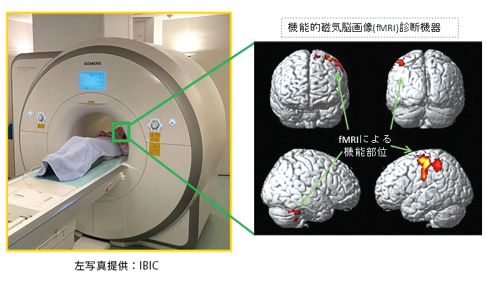 MRI機器と脳画像