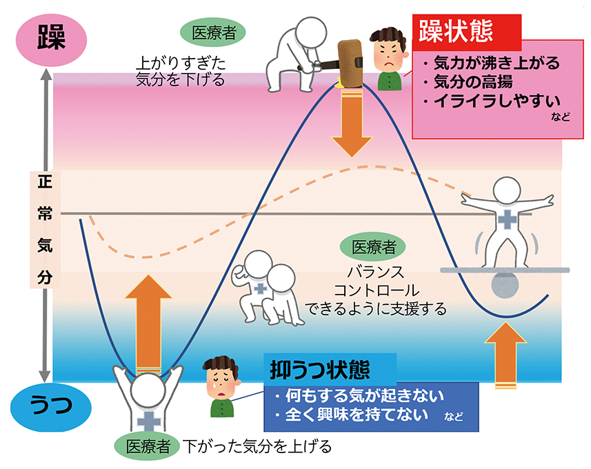 双極性障害のイメージ図