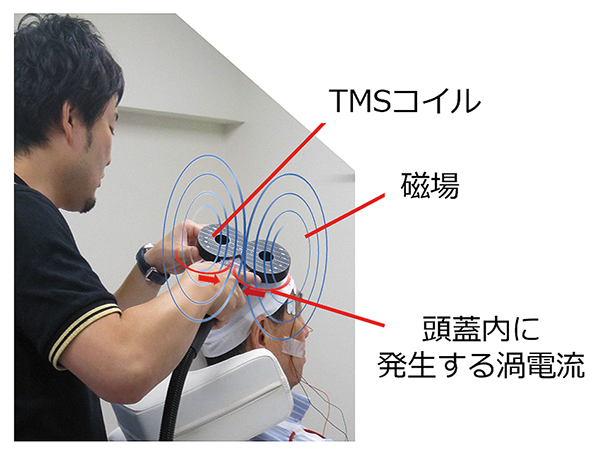 rTMS運動閾値測定中の様子の写真