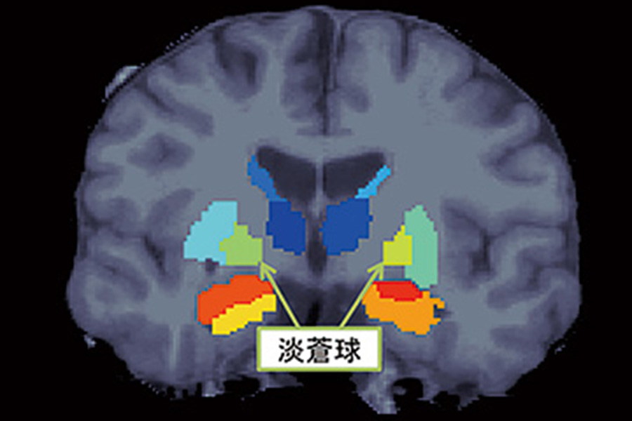 説明図