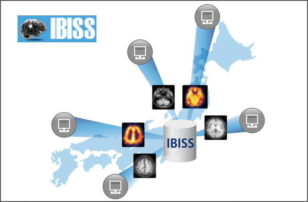 図1:IBISSの概念図