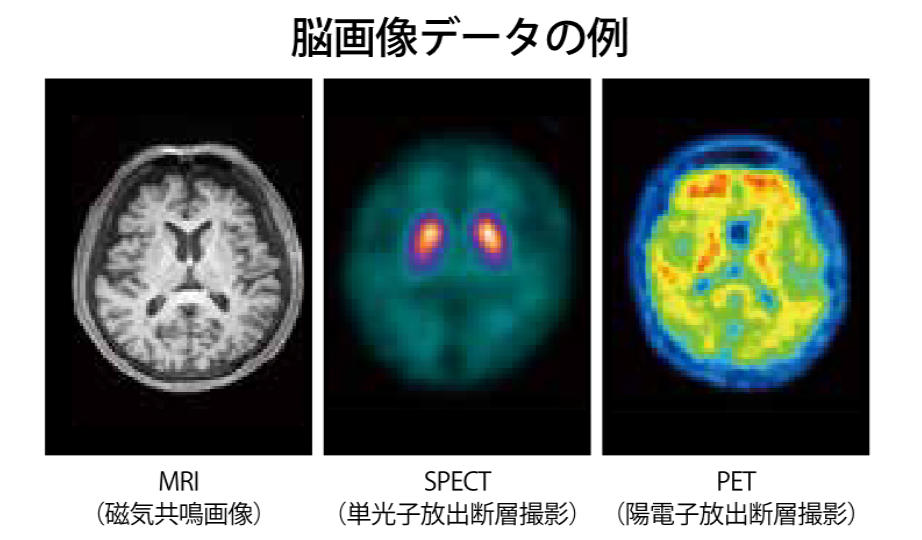 図2:集積している脳画像データの一例
