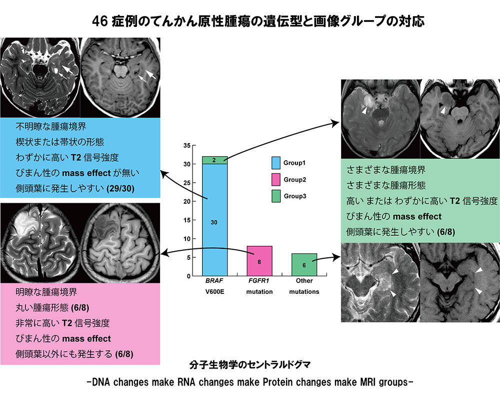 46症例のてんかん原生腫瘍の遺伝型と画像グループの対応グラフ