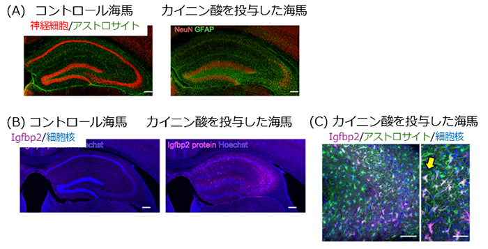 てんかん発作悪化の治療ターゲットの発見～アストロサイトの分泌分子「Igfbp2」～