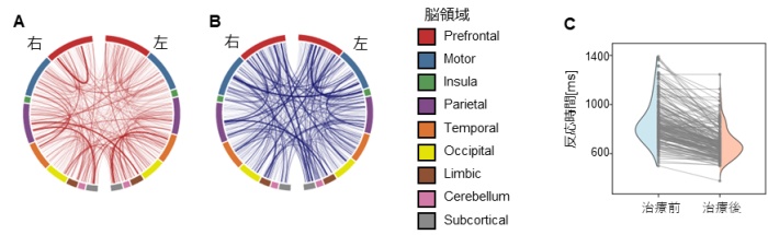 【図2】処理速度向上のための介入ターゲットと治療シミュレーションの効果 (A, B) 最適な介入ターゲットの特定： 処理速度（反応時間）を向上させるために、強化すべき脳の機能的結合（A：赤色）と、弱化すべき結合（B：青色）を可視化したもの。 (C) 治療効果の個人差： バーチャル介入前（Pre：水色）と介入後（Post：オレンジ色）の反応時間の変化。介入によって反応時間が短縮（改善）していますが、その変化量には個人差があることが見て取れます。