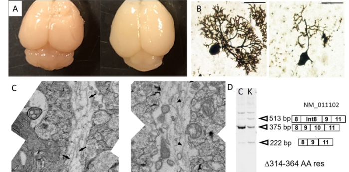 【図１】Snupn遺伝子変異ノックインマウスの表現型 A, 成体マウスの脳。KIマウスにおいて小脳の萎縮が見られる(左：正常マウス、右：KIマウス)。B, 24日齢マウス小脳プルキンエ細胞のゴルジ染色。KIマウスでは樹状突起の形成不全が見られる(左：正常マウス、右：KIマウス)。C, 10日齢マウスプルキンエ細胞突起の電子顕微鏡像。正常マウス（左）で見られる太い線維（微小管）（矢印）は, KIマウス（右）では見られず、細い線維のみ観察される（矢じり）。D, KIマウス小脳でのRNAスプライシング異常の一例。Prckg遺伝子産物を示す。正常マウス（C）で見られる転写産物がKIマウス（K）では減少し、他の産物が生成されている。