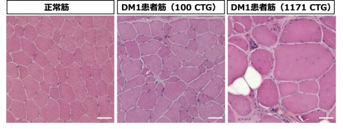 【図1】正常筋およびDM1患者筋のH&E染色画像