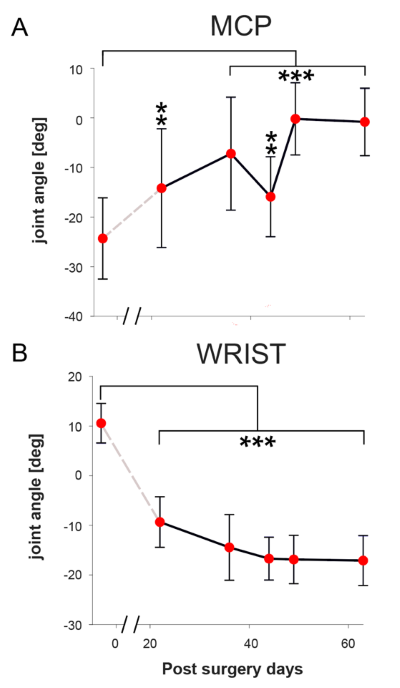 図2　運動学的解析により明らかにされた代償運動の学習曲線