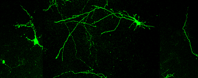 筋萎縮性側索硬化症(ALS)を引き起こすタンパク質の新機能を発見 ~新たな治療法開発に期待~