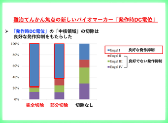 難治てんかん焦点の新しいバイオマーカー「発作時DC電位」 ―国内5施設の共同研究での世界初の成果―