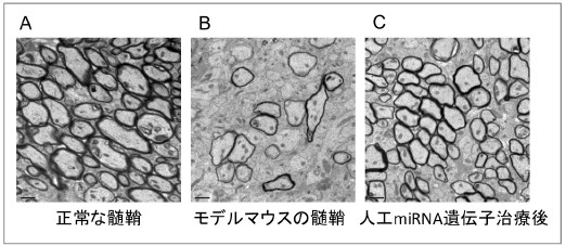 図2.正常マウスとPMDモデルマウスの脳の髄鞘(ミエリン)の電子顕微鏡の写真