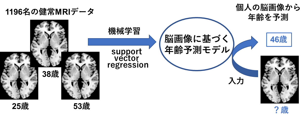 [図2]機械学習による、脳画像に基づいた年齢予測モデルの構築と、個々の脳画像への応用