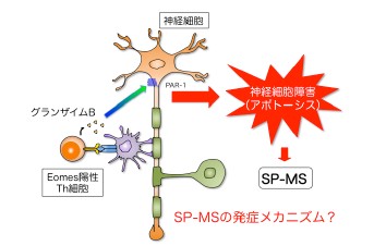 神経難病「進行型多発性硬化症」の病原性リンパ球の生成機序を解明～プロラクチンが脳の慢性炎症誘導において重要な役割を果たす～