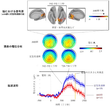 自閉スペクトラム症と嗅覚―嗅覚誘発脳波の評価によって嗅覚処理の後期に認められた脳活動の違い―