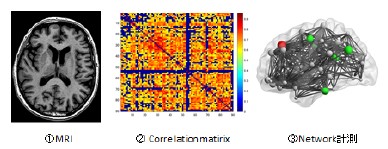 【図1】①MRI ②Correlationmatirix ③Network計測