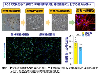 図3POGZに変異を持つ患者のiPS細胞由来の神経幹細胞は神経細胞に分化する能力が低い。患者血液細胞からiPS細胞を樹立した。