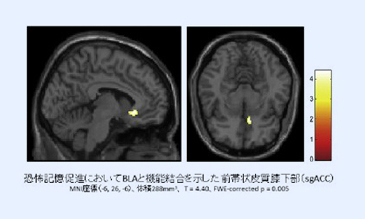 扁桃体外側基底核の機能結合が恐怖記憶の形成促進に特異的に関わることを発見 -ストレス関連精神障害の発症メカニズムの解明および予防に役立つ可能性 -