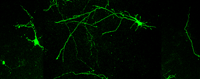 筋萎縮性側索硬化症(ALS)を引き起こすタンパク質の新機能を発見 ～新たな治療法開発に期待～