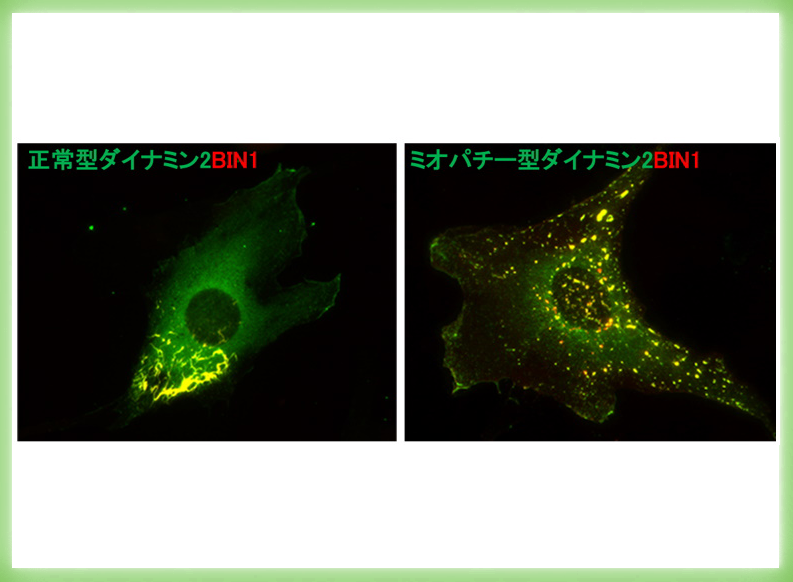 先天性ミオパチーの発症メカニズムを分子レベルで解明！ ～骨格筋の難病の診断・治療法開発に光～　