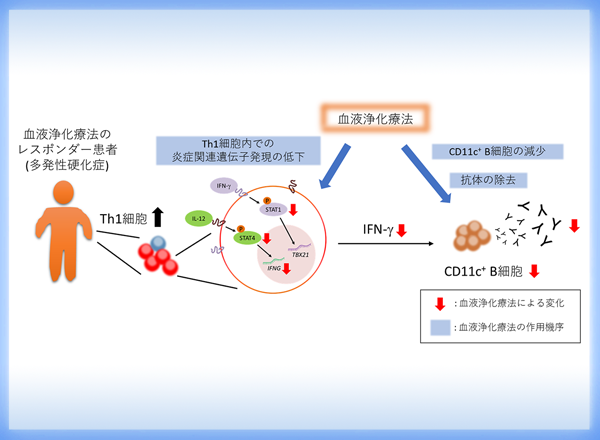 多発性硬化症に対する血液浄化療法の作用機序解明と個別化医療への期待