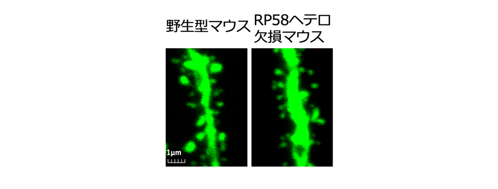 図2　スパインの形態の神経画像