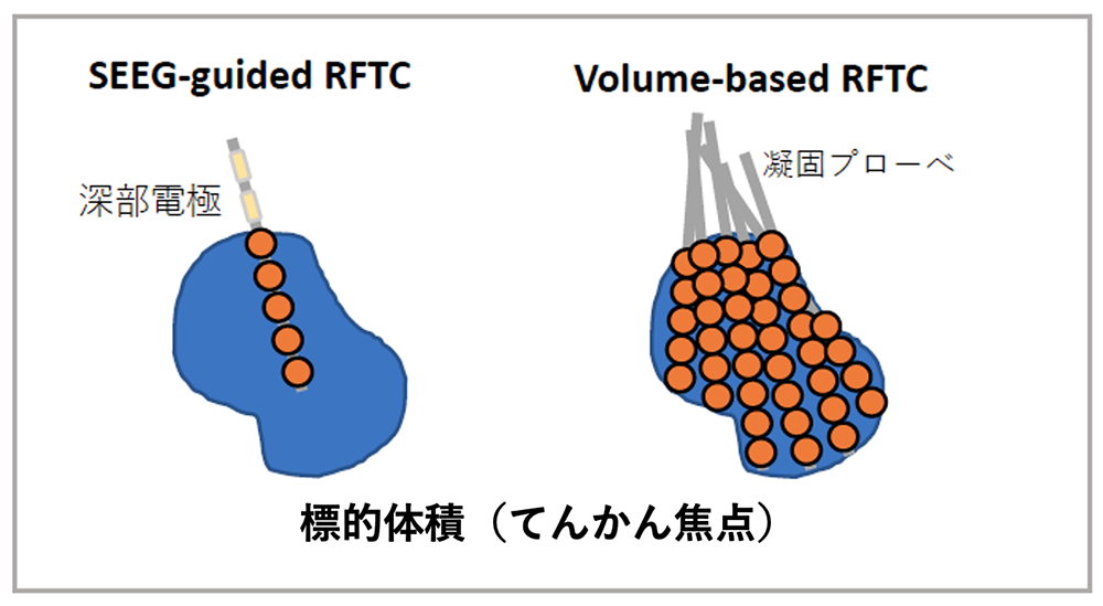 図１：Volume-based RFTCのコンセプト図