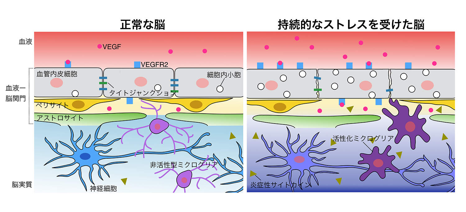 正常な脳と持続的なストレスを受けた脳の図