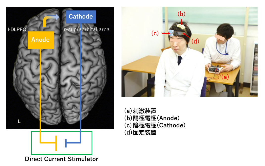 図1： tDCS（経頭蓋直流電気刺激）の模式図と実施の様子