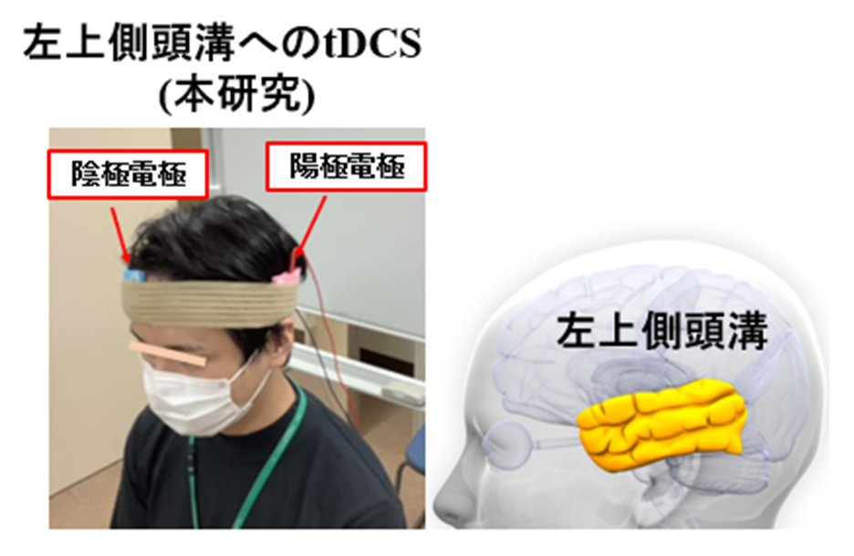 図2:社会認知機能を対象としたtDCS実施の様子