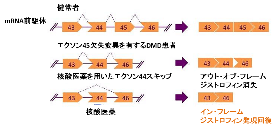 エクソン・スキップ治療の概念図