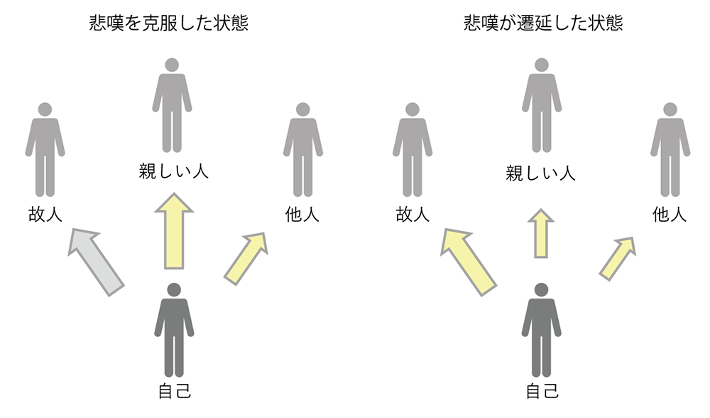 悲嘆の遷延における愛着的絆と共感性の偏り（仮説）の図