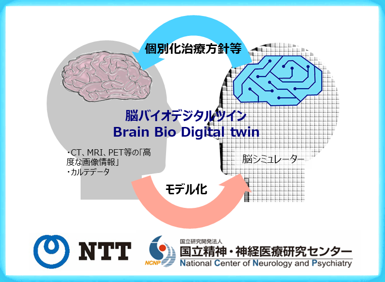 NCNPとNTT、「脳バイオデジタルツイン」の実用化に向けたパートナーシップ協定を締結 ～認知症等患者の負担軽減、疾患の早期発見・予防をめざす～