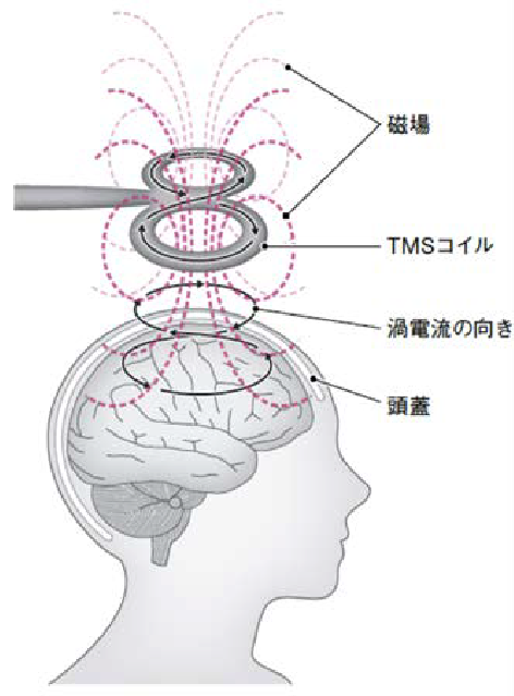 コイルによる脳内刺激電流の発生の図